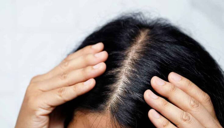 Here is the Right Way of Treating a Sensitive Scalp: According to Dermatologists!