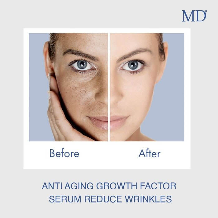MD® Stem Cell Factor 55 - Best Anti-Aging Serum For Men And Women 30ml 60 Days Supply - MD