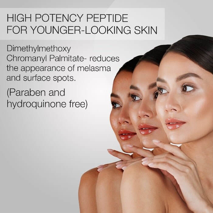 Woman’s complexion visibly brightens – MD Skin peptide formula reduces melasma and brown spots, hydroquinone- and paraben-free